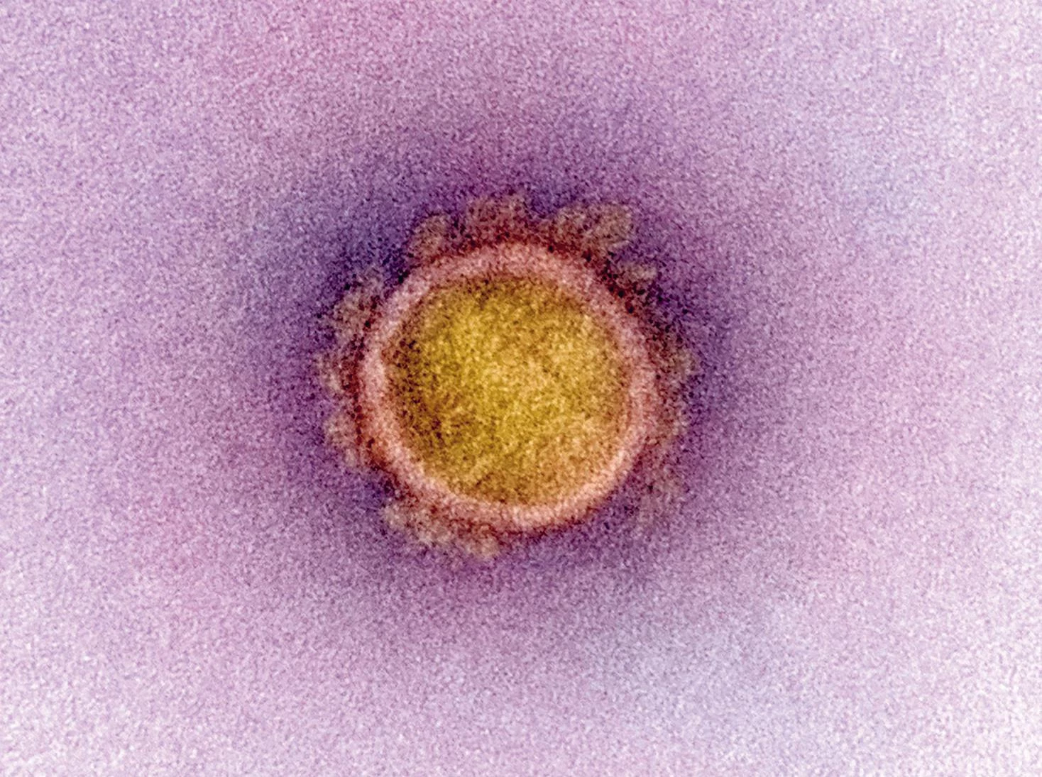Cien días del virus